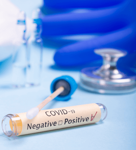 Toma muestra RT-PCR para<br>SARS-CoV-2 (COVID-19)